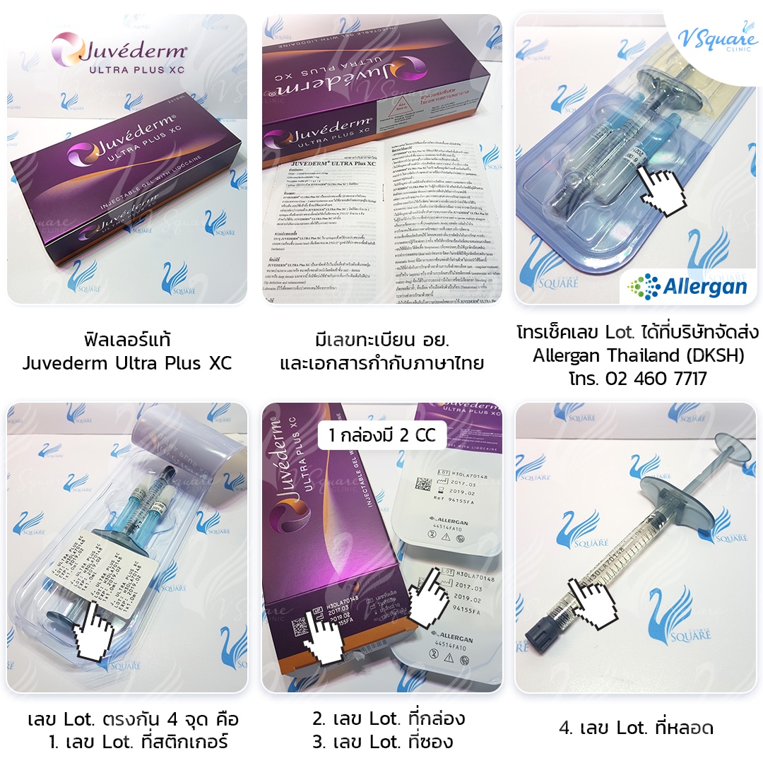 ฟิลเลอร์ร่องแก้ม Juvederm Ultraplus