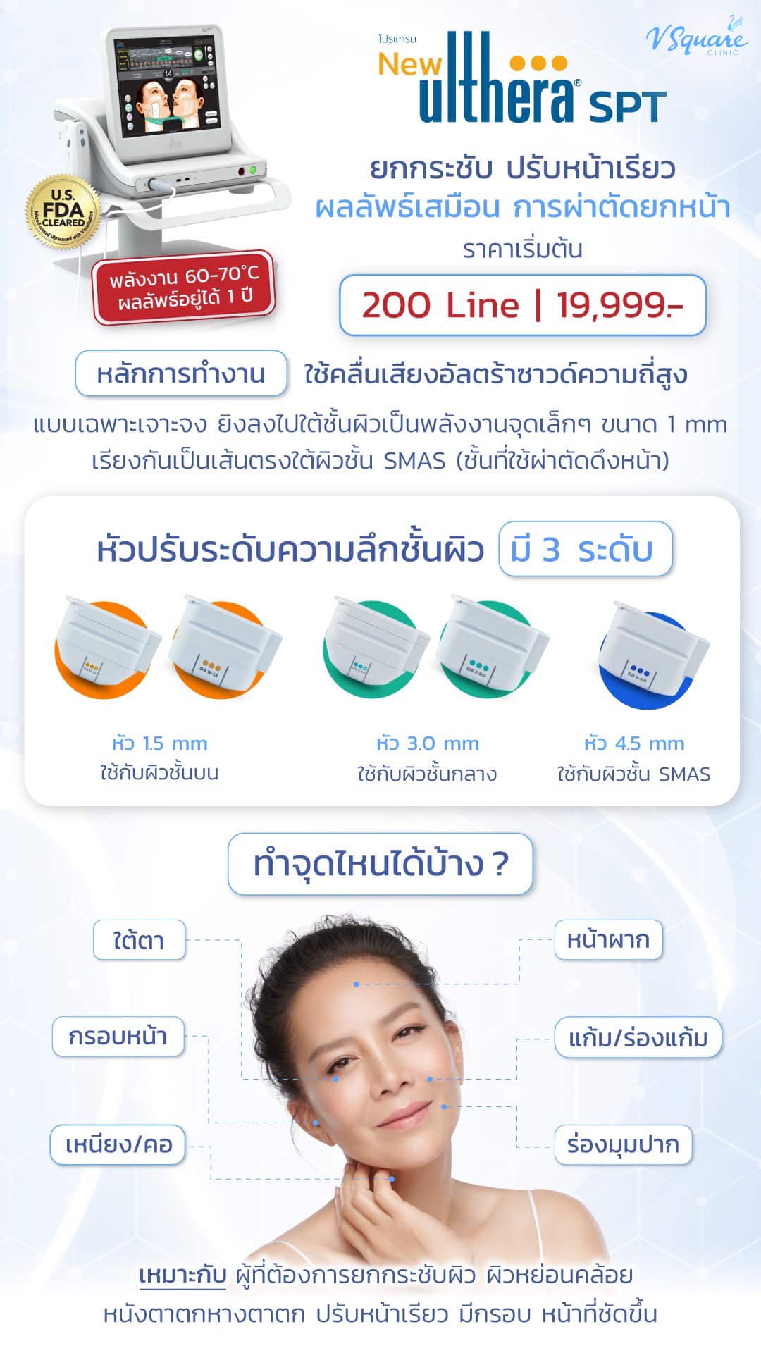 หลักการทำงานของ Ulthera คุณต่าย