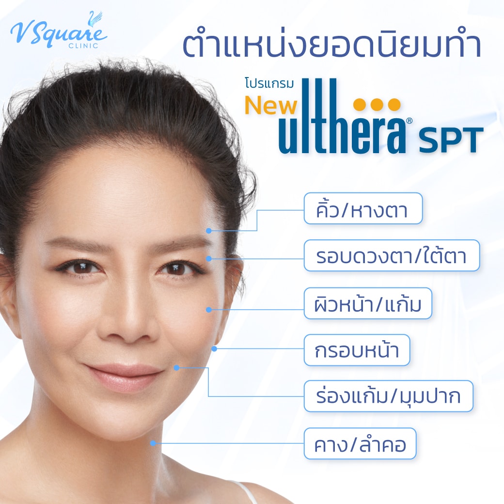 Ulthera SPT ทำจุดไหนได้บ้าง คุณต่าย