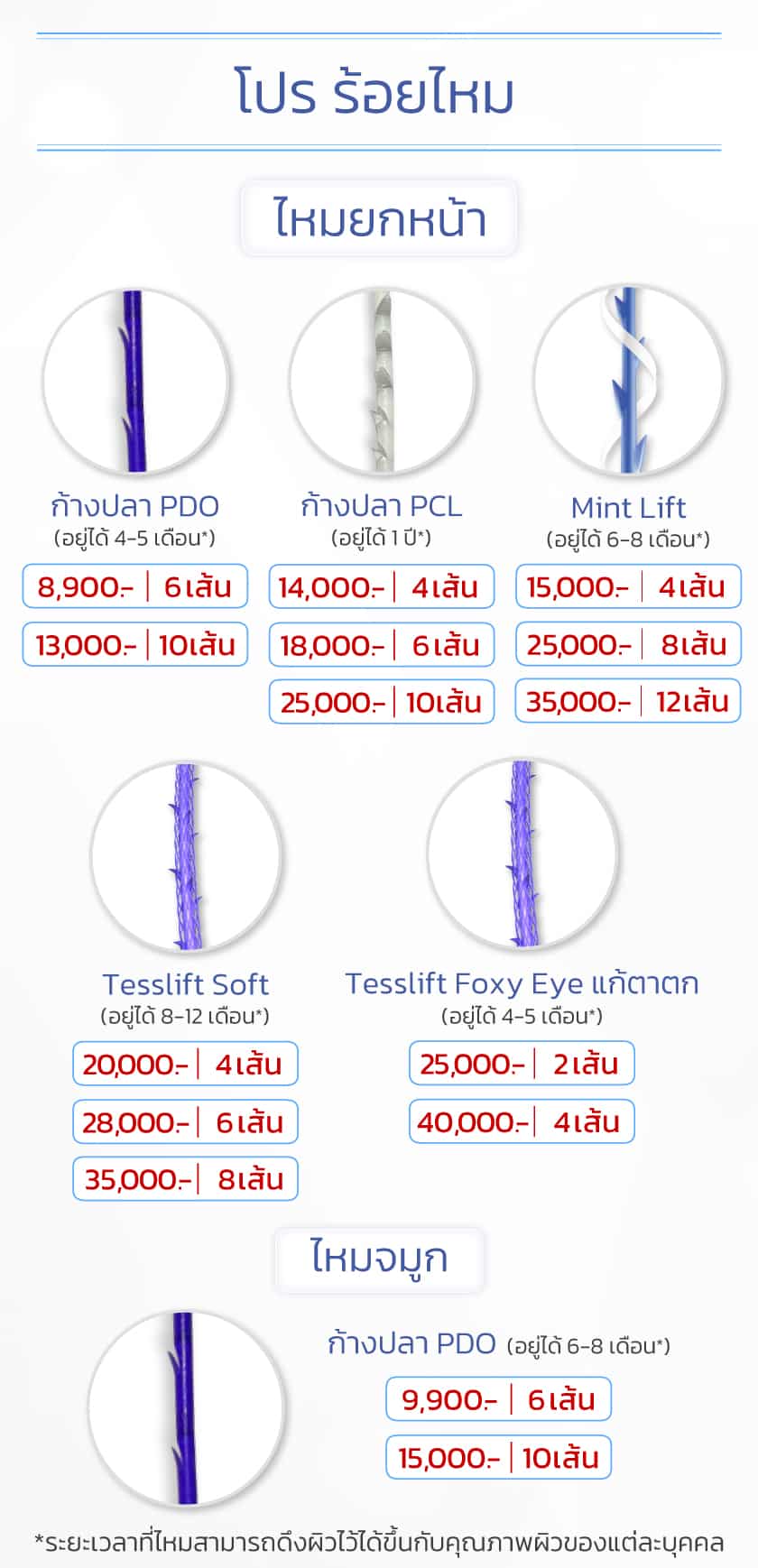 ควรร้อยไหมก้างปลา กี่เส้น