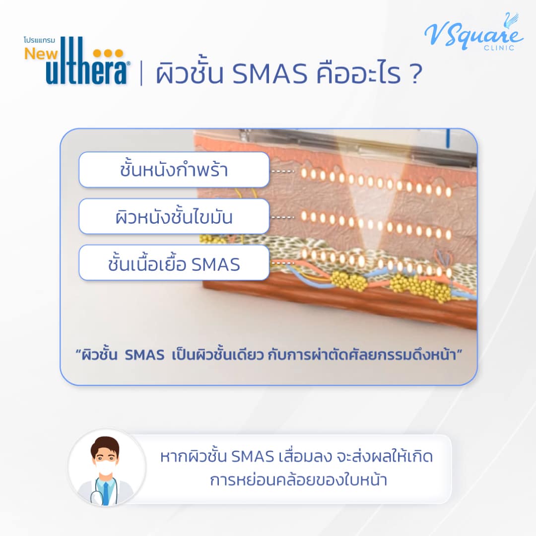 ulthera ส่งพลังงานลึกถึงชั้น SMAS