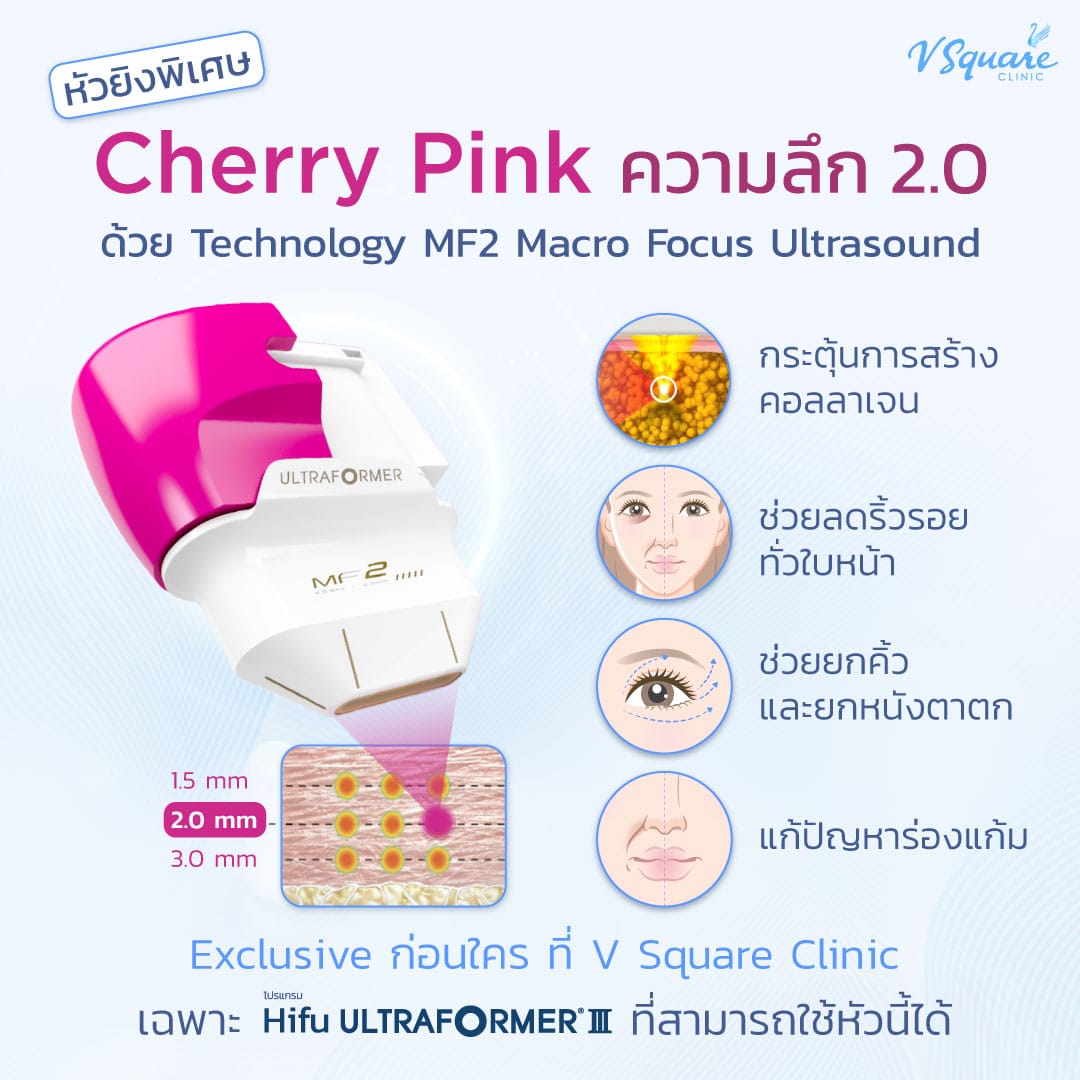 หัวพิเศษ hifu cherry pink