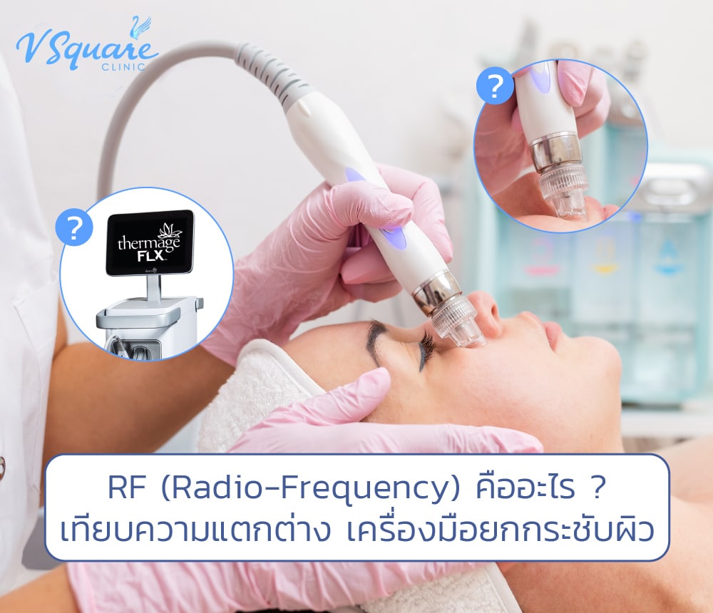 RF (Radio-Frequency)