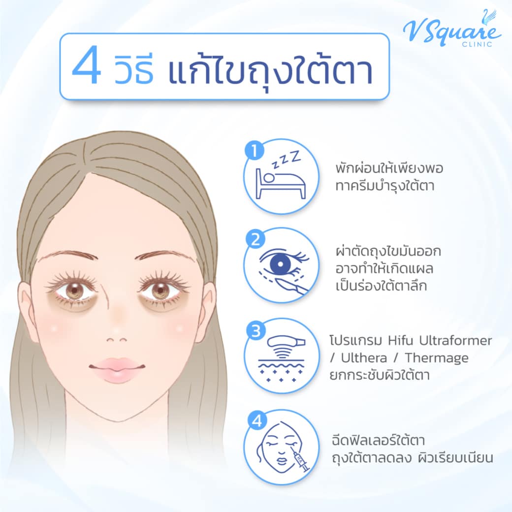 วิธีแก้ปัญหาถุงใต้ตา