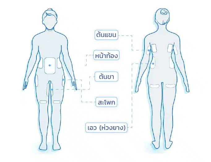 รวมวิธีลดต้นขาใหญ่ ออกกำลังกาย ไม่ต้องออกกำลังกาย แบบไหนได้ผล ?