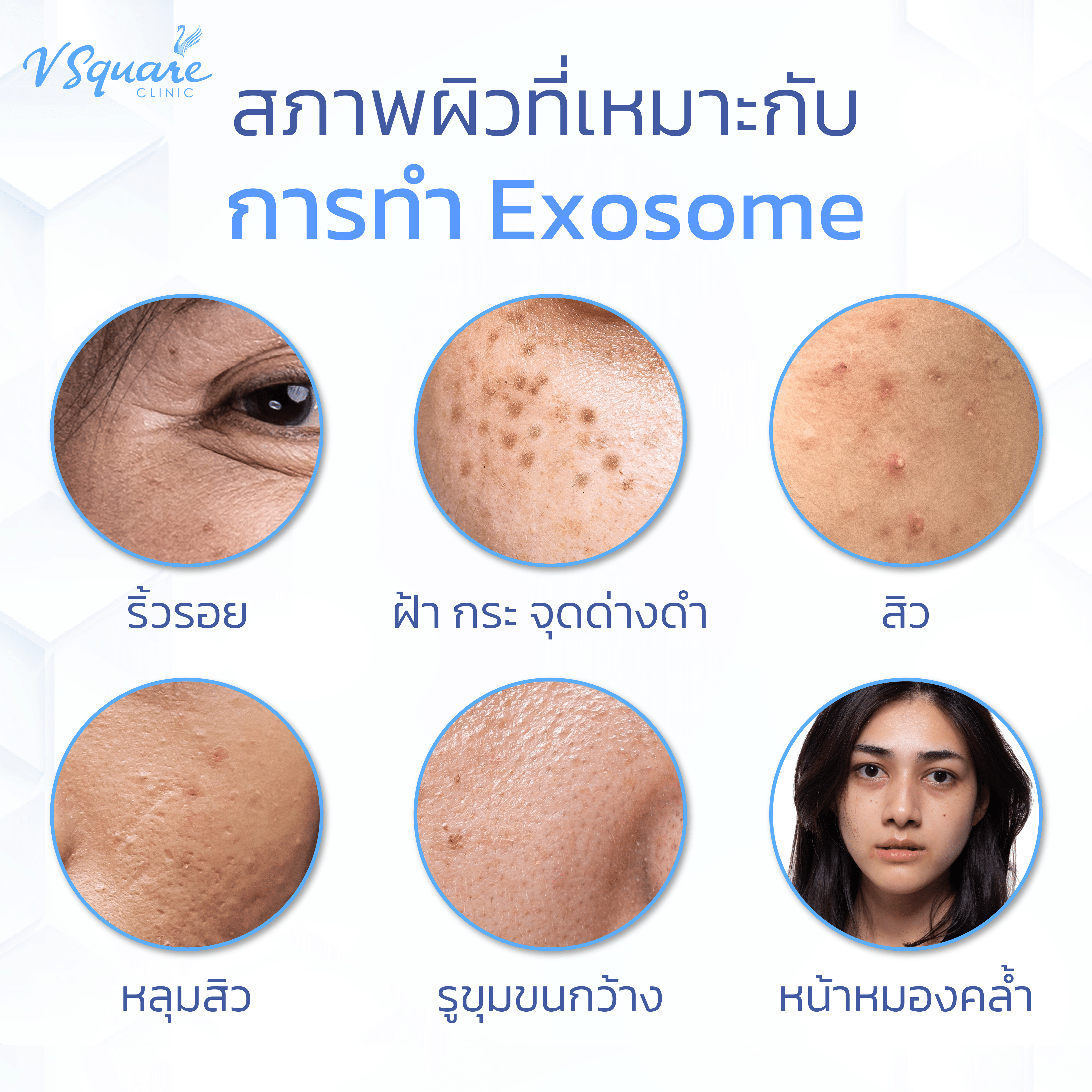 exosome เหมาะกับใคร