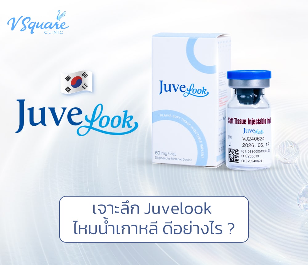 Juvelook