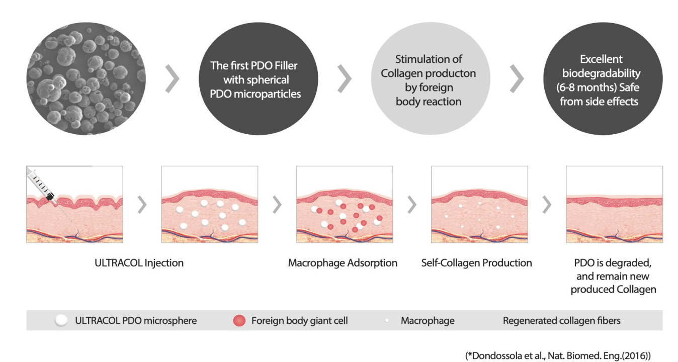 การทำงานของ Ultracol