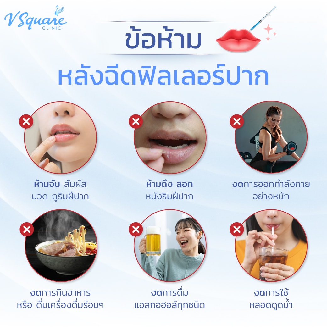 ข้อห้ามหลังฉีดฟิลเลอร์ปาก