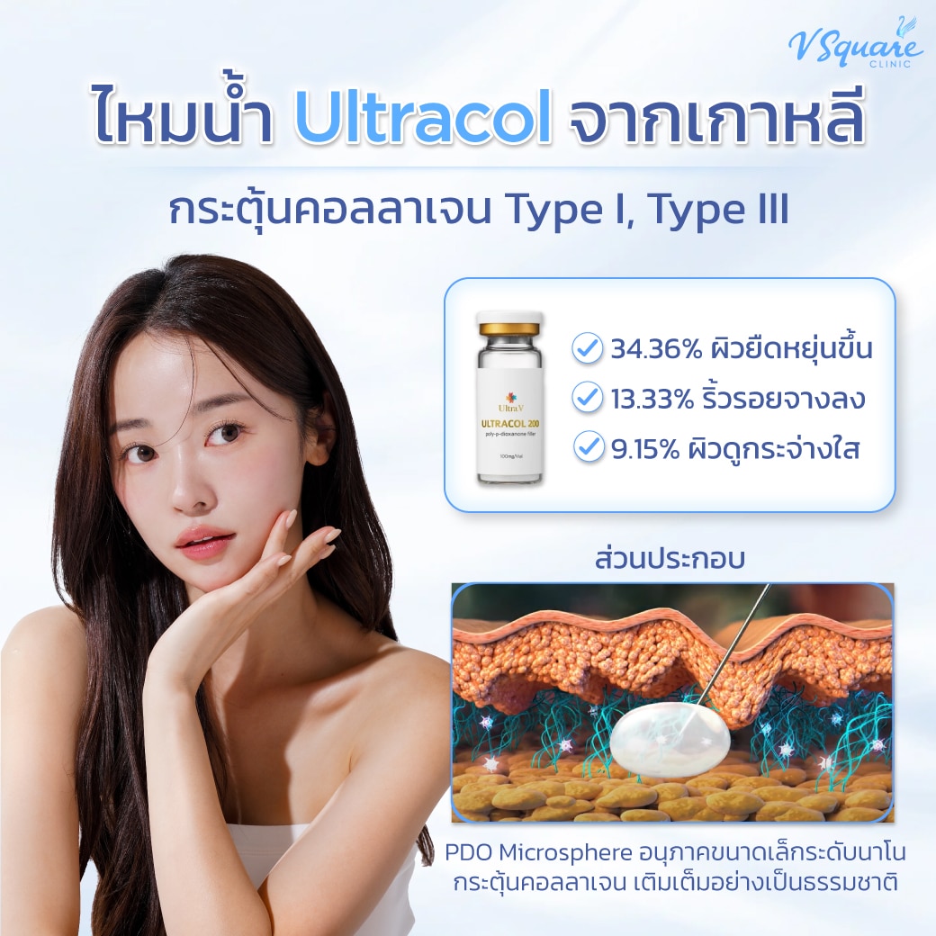 ไหมน้ำ ultracol