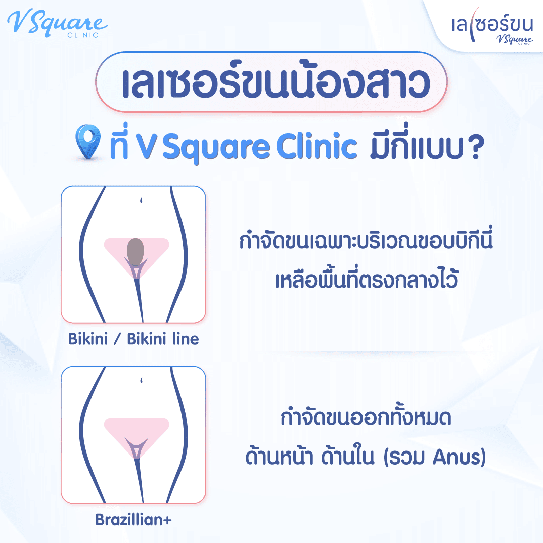 เลเซอร์บิกินี่ กับ บราซิลเลี่ยน ต่างกันยังไง