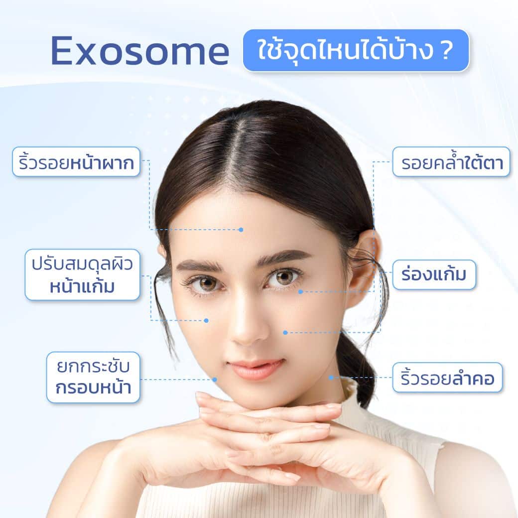 ทำ Exosome ตำแหน่งไหนได้บ้าง