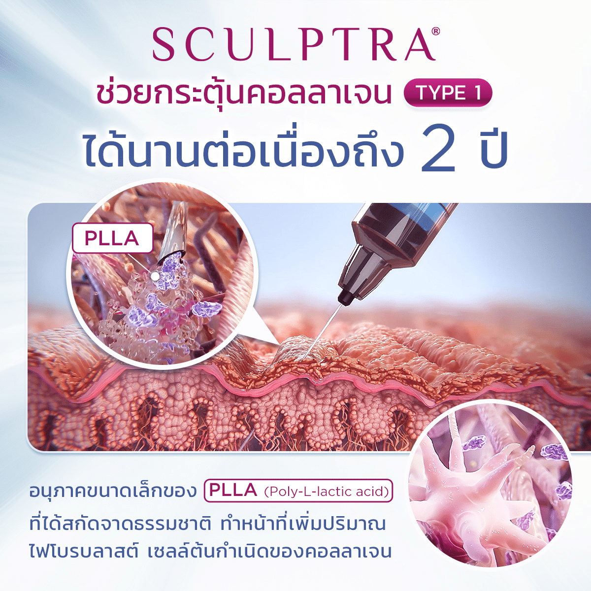 Sculptra PLLA