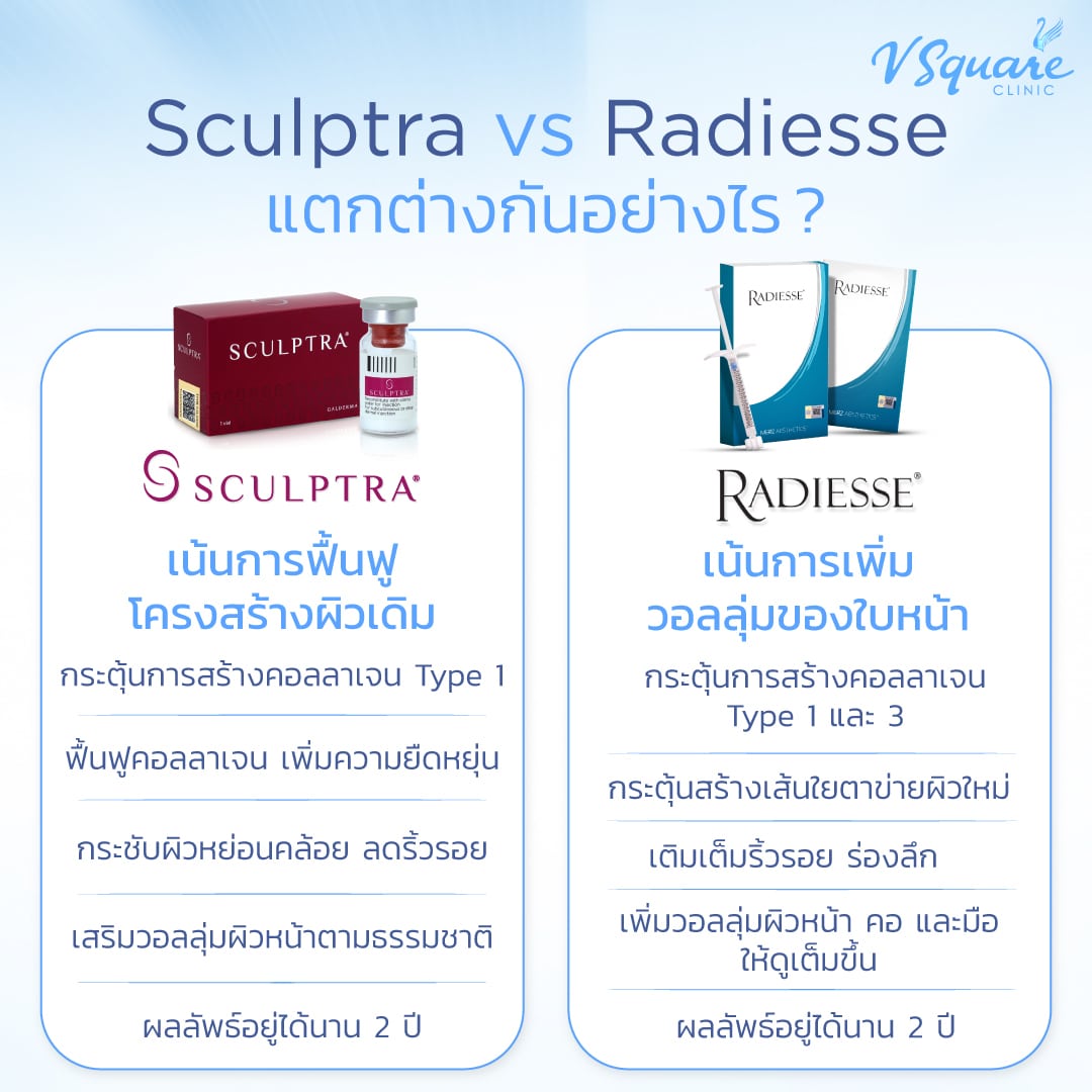 Sculptra vs Radiesse