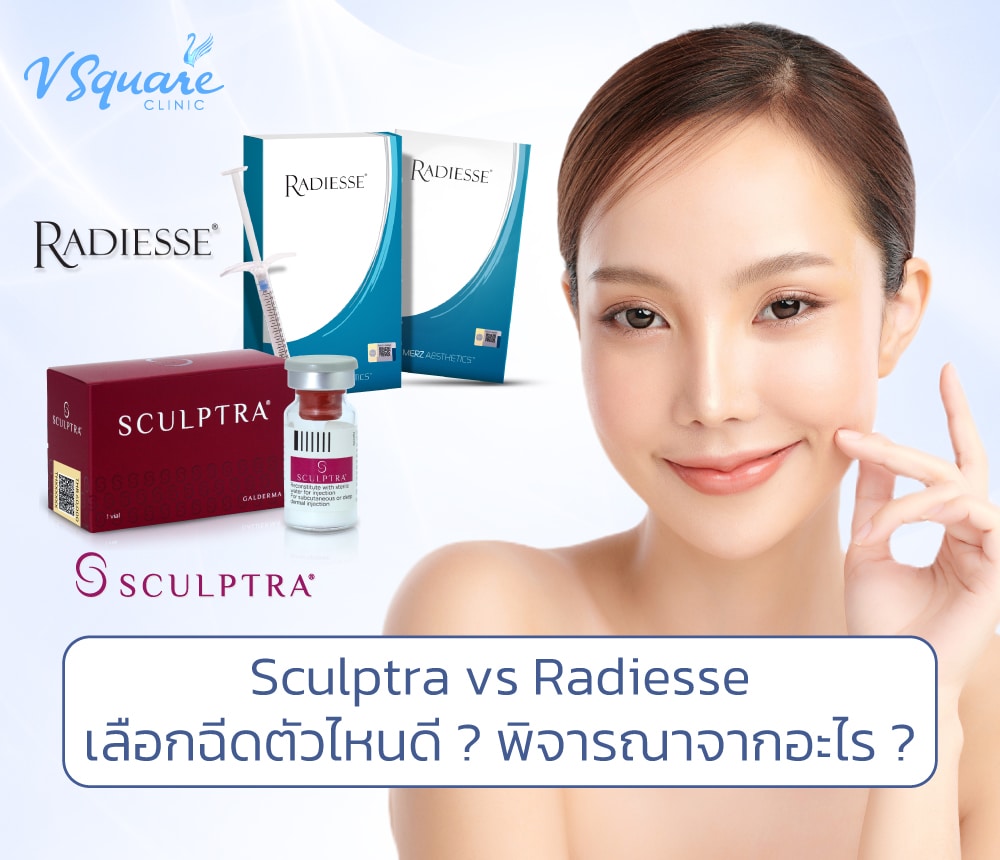 Sculptra vs Radiesse