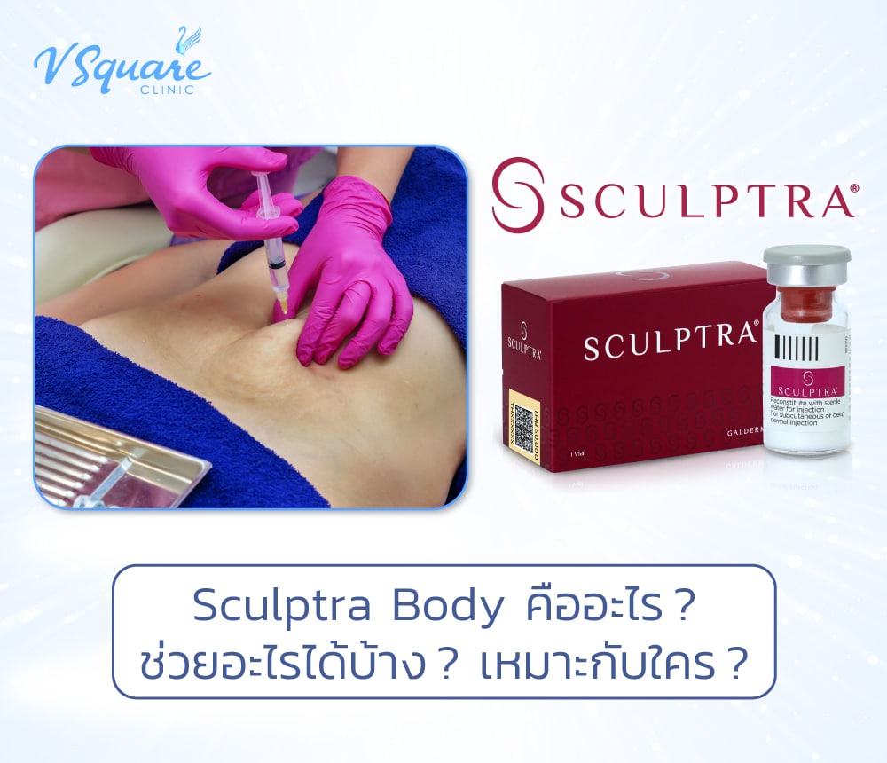 sculptra body