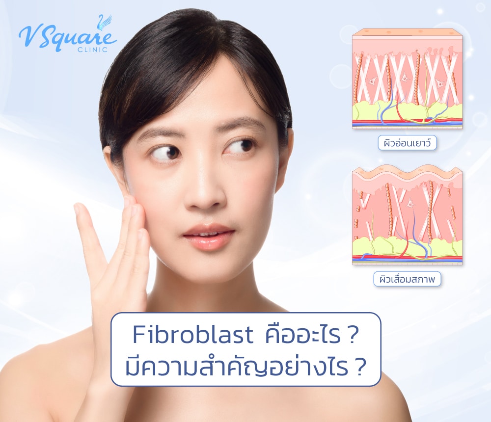 Fibroblast