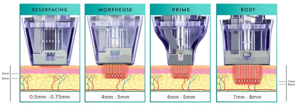 กระบวนการทำงานของ morpheus8