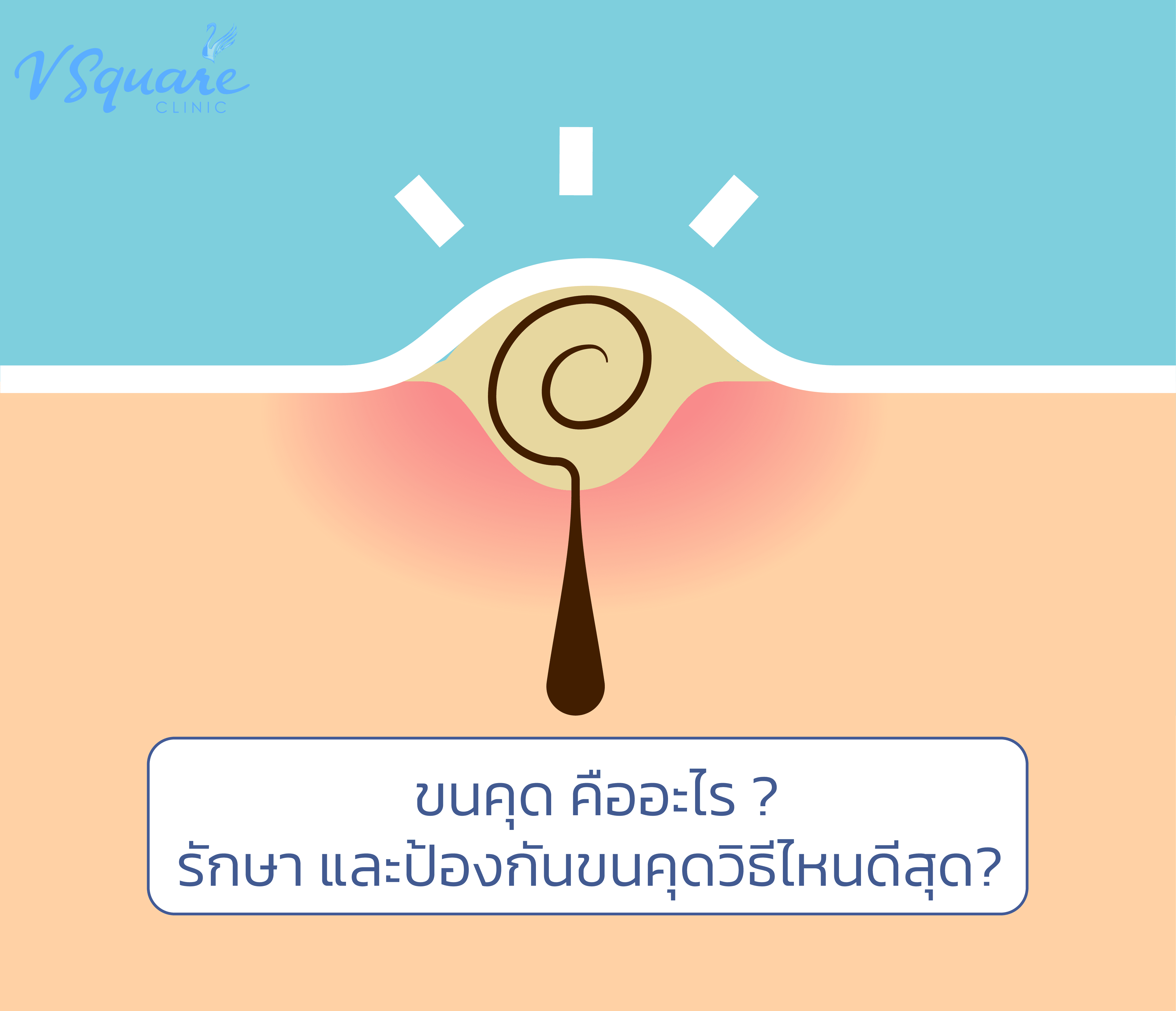 ขนคุด