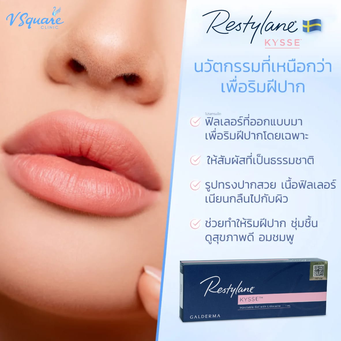 ฟิลเลอร์ปาก Restylane Kysse