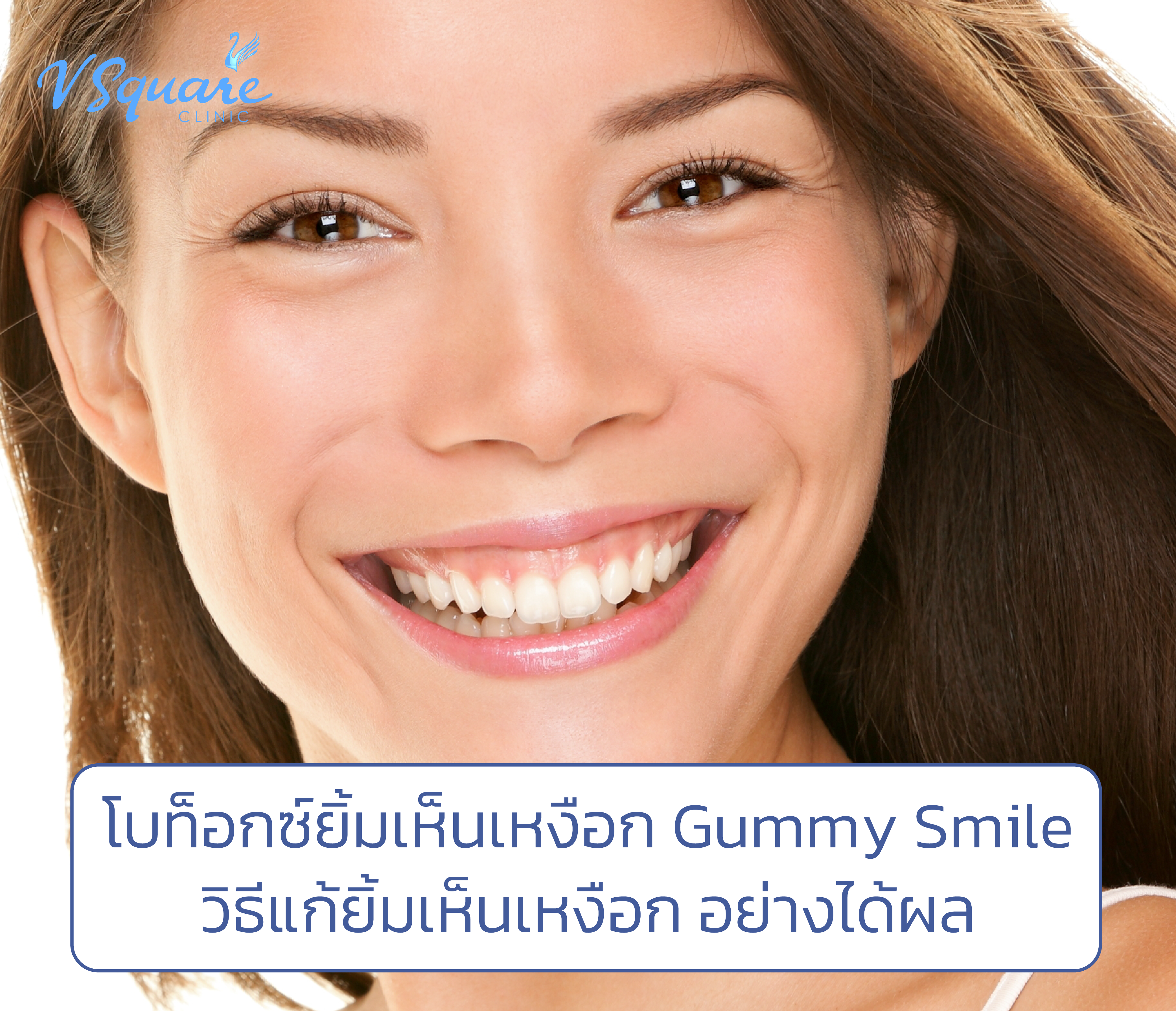 โบท็อก ยิ้มเห็นเหงือก