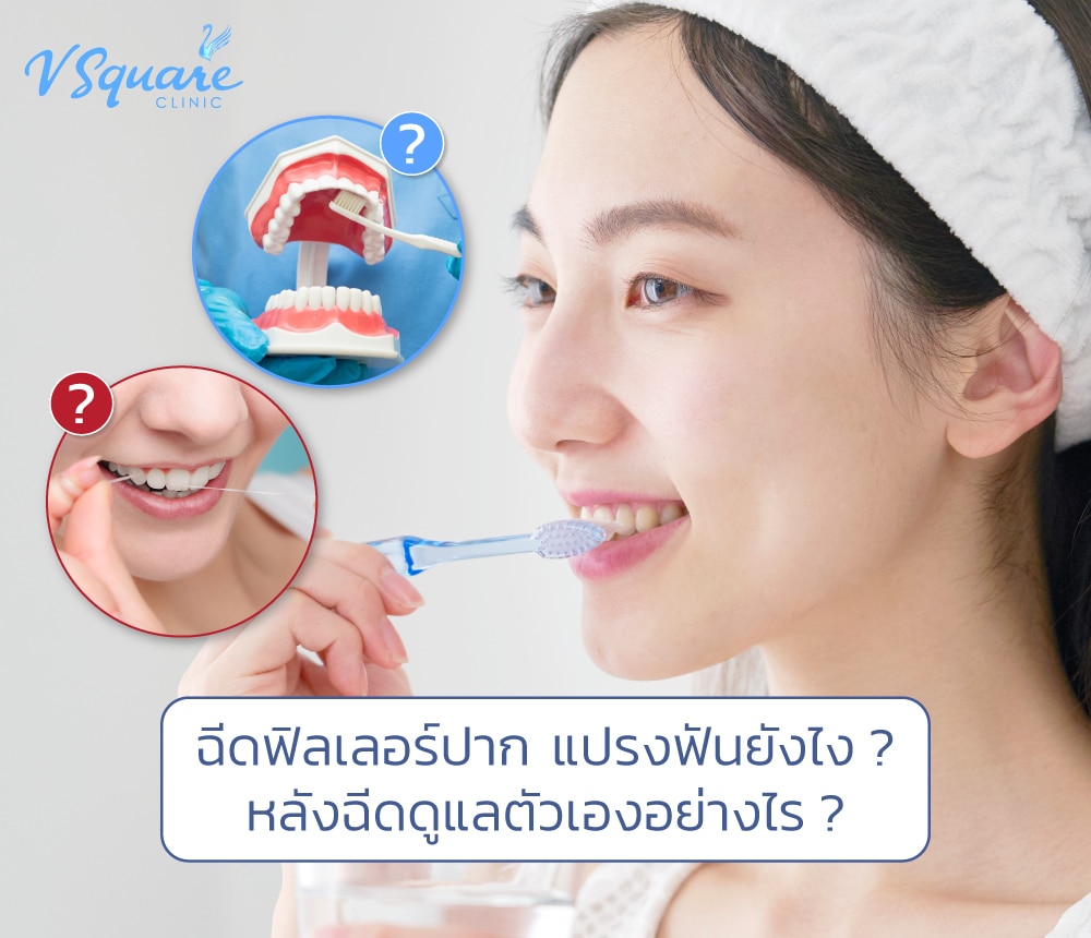 ฉีดฟิลเลอร์ปาก แปรงฟันยังไง