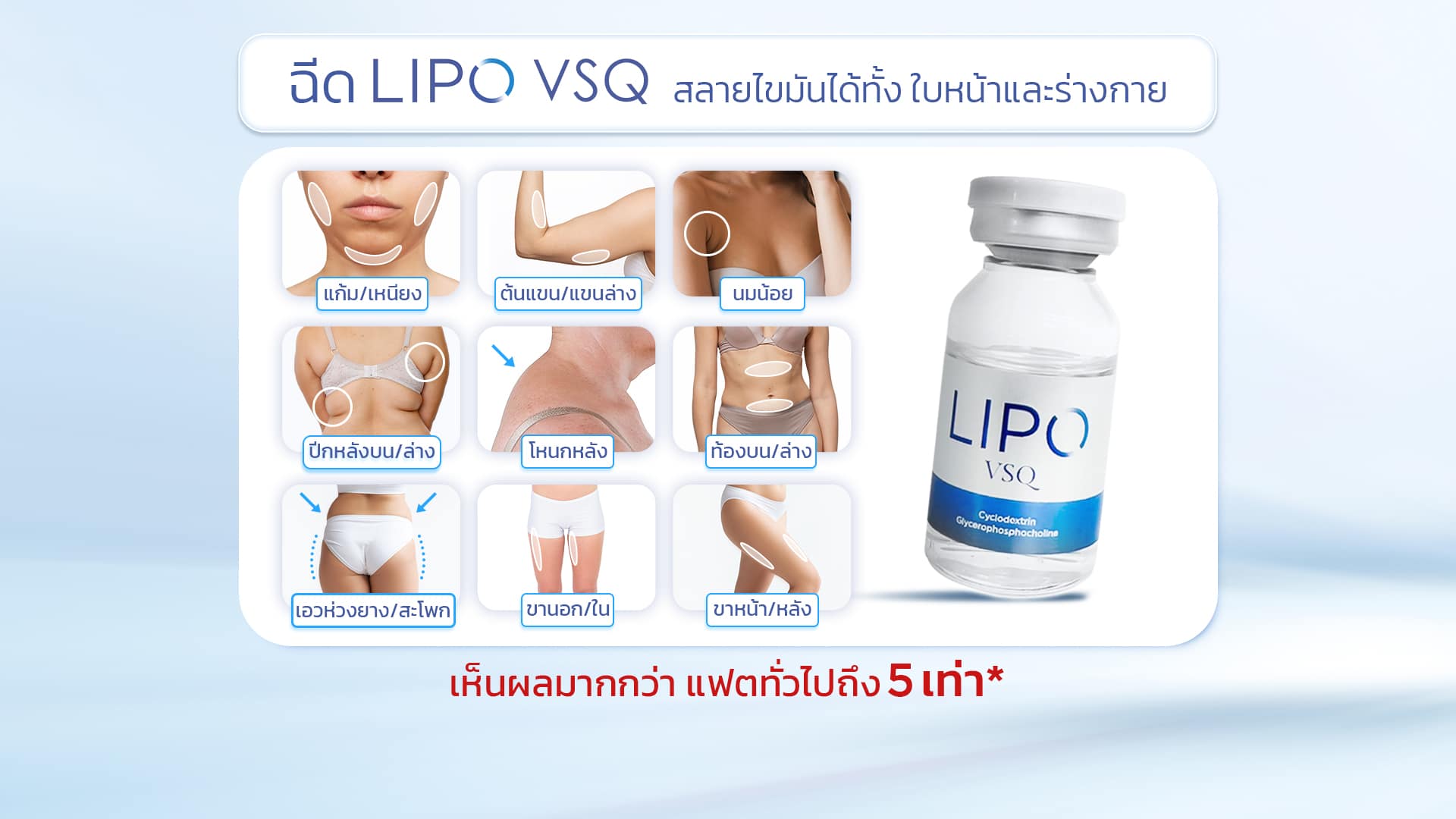 Lipo VSQ ฉีดจุดไหนได้บ้าง ?