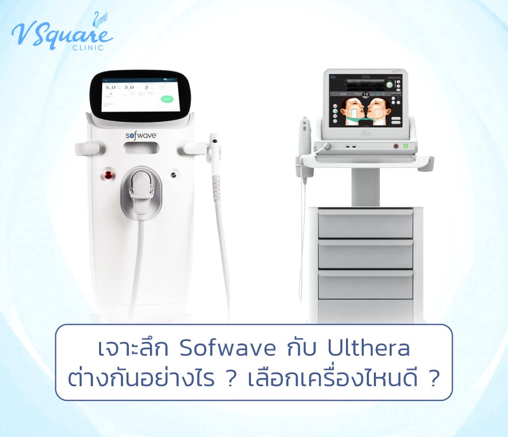 Sofwave กับ Ulthera