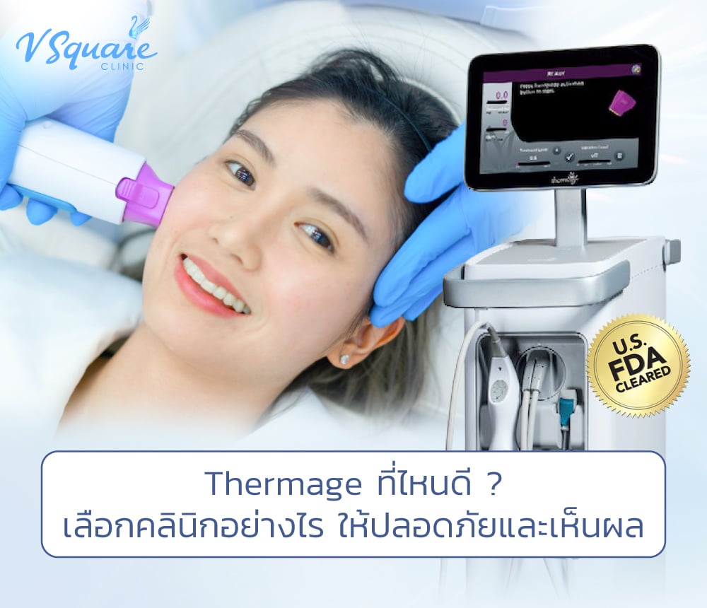 thermage ที่ไหนดี